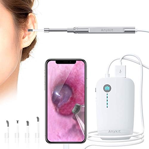 Anykit Otoscope for iPhone and Android
