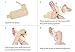 Bracoo Wrist Brace with Thumb Stabilizer, Removable Orthosis for Chronic Tenosynovitis, Carpal Tunnel Syndrome Relief, Sprains (Right Hand), TP31, 1 Count