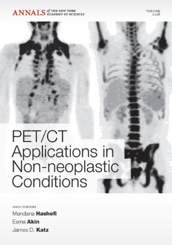 PET/CT Applications in Non-Neoplastic Conditions