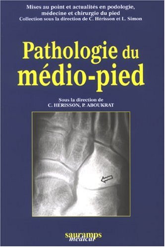 Pathologie du médio-pied