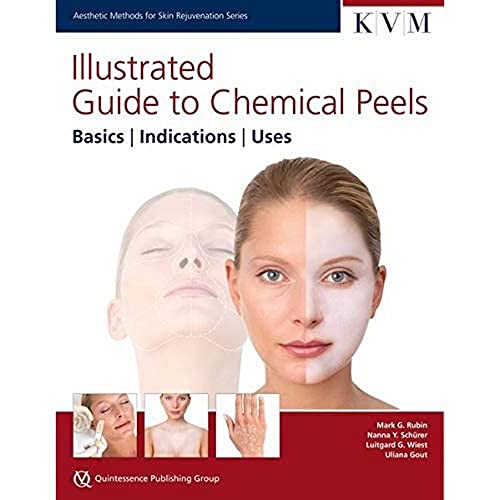 Illustrated Guide to Chemical Peels: Basics | Indications | Uses (Aesthetic Methods for Skin Rejuvenation)