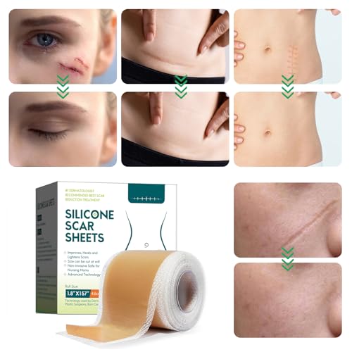 ZODENIS Scar Away Silicone Scar Sheets, Scar Tape(1.8” x 157”Inch- 4M), Scar Strips, Reusable, Professional Scar Remover for C-Section, Surgery, Keloid, Tummy Tuck, Scar Patch, Scar Pads.