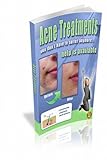 Laser Acne Treatment