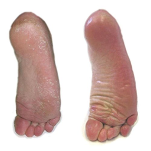Corn and Callus Serum One Color One Size