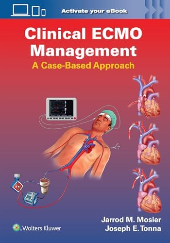 The ECMO Book: 9780443111983: Medicine & Health Science Books