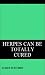 Herpes Can Be Totally Cured