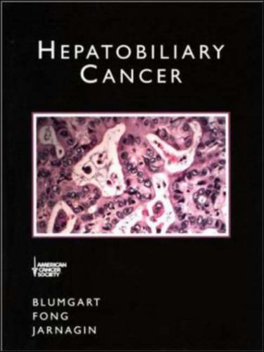 HEPATOBILIARY CANCER
