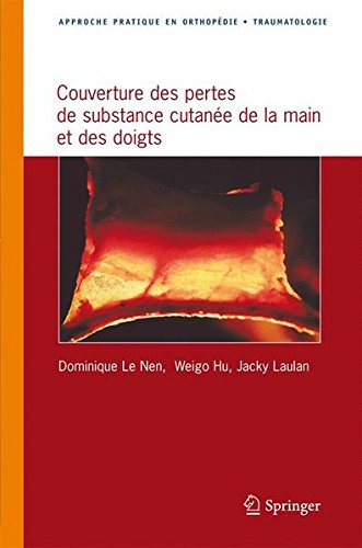 Approche pratique de la couverture des pertes de substance cutanée de la main et des doigts