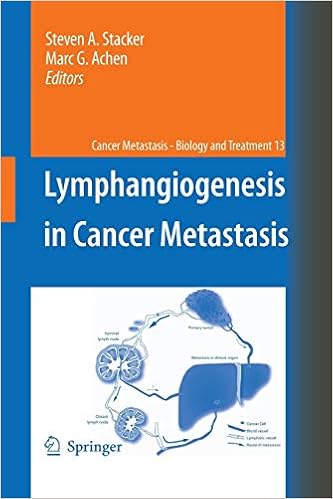 Lymphangiogenesis and cancer metastasis