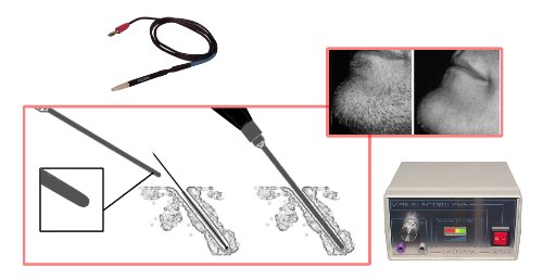 V2R Galvanic Electrolysis System for Permanent Hair Removal Face/Body