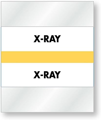 United Ad Label X-Ray Divider Tab, 1-1/2" x 1-1/4", Tan - 100 Tabs Per Pack