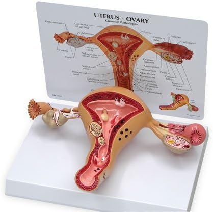 Amazon 3b社 女性疾患 子宮と卵巣の疾患モデル W 3b社 人体模型