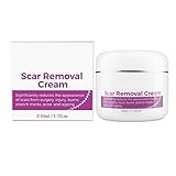 HIGERH Skin Rebound Scarless Cream, Scar Removal