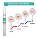 Puriderma Fungus Nail Repair Pen, Fungal Nail Eliminator for Fingernails and Toenails, Repairs & Protects from Discoloration, Brittle and Cracked Nails 4pcs