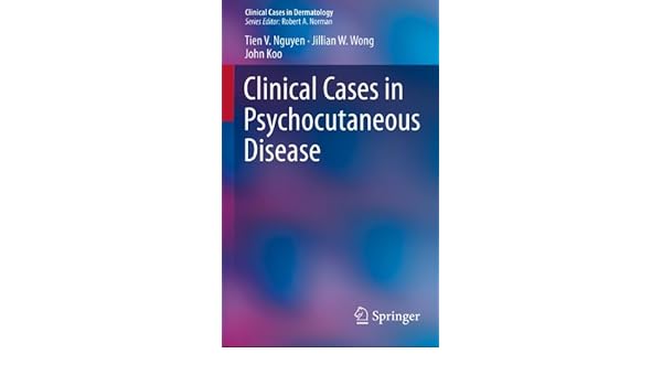 Subscription Options