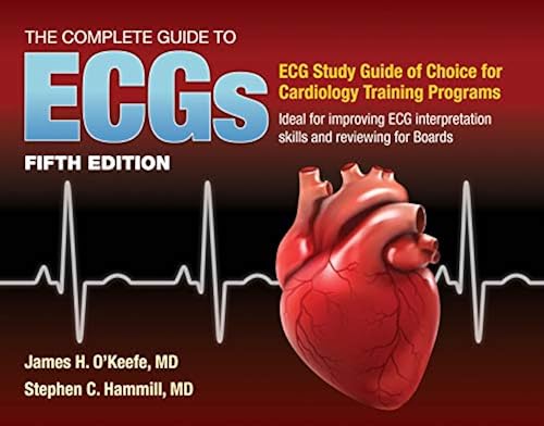 The Complete Guide to ECGs: A Comprehensive Study Guide to Improve ECG ...