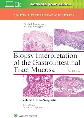 Tumors of the Prostate Gland, Seminal Vesicles, and Scrotum (AFIP