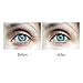 Cell Renewing Eye Gel Best for Under Eye Dark Circles, Puffiness, Bags and Wrinkles | With Anti-Aging Echinacea, Hyaluronic Acid and Licorice by Kenko Botanics | 15ml