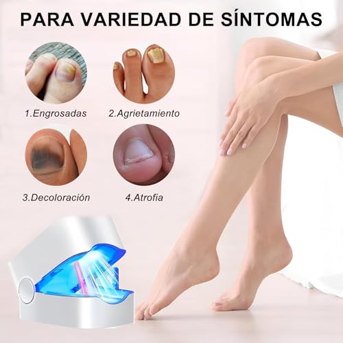 TRYXZSZ Dispositivo Portátil de Limpieza en las Uñas, Pequeño y lindo, fácil de usar, Combinación luz Dual 905 nm y 470 nm, Ciclo de Uso de 7 Minutos, Ayuda a Aliviar las Molestias en las Uñas