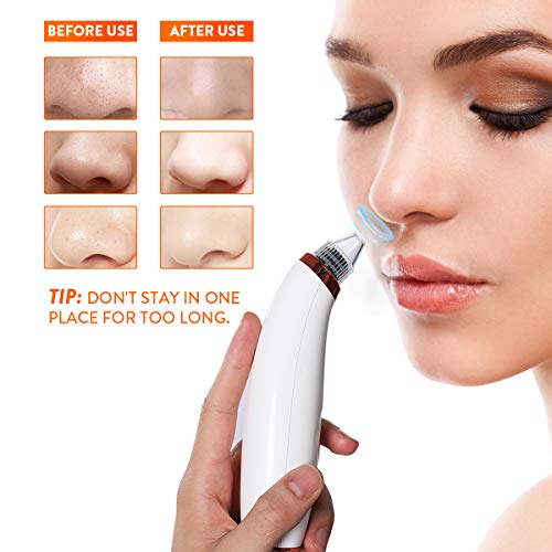 Aspirateur Point Noirs, liaboe Nettoyant de Pores Rechargeable Appareil de Beauté du Visage Avec écran LED, 5 Sondes et 3 Modes, 4 Sondes kit Éliminer les Acnés Comédons