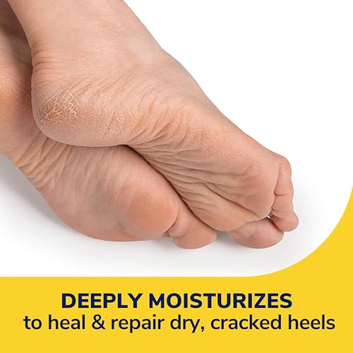 DR. SCHOLL’S SEVERE CRACKED HEEL REPAIR RESTORING BALM 2.5OZ, WITH 25% UREA FOR DRY, CRACKED FEET, HEALS AND MOISTURIZES FOR HEALTHY FEET