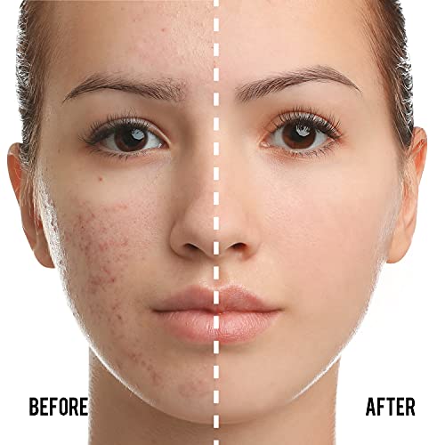 CATKIN Cushion Makeup Foundation, Lightweight and Durable Formula, Anti-Aging, Natural Effect, 7 in 1 Herbal Extracts, Transparent Satin Finish, Refills Included, 13g*2