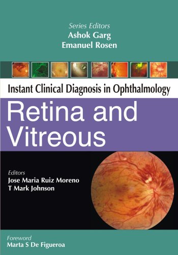 INSTANT CLINICAL DIAGNOSIS IN OPHTHALMOLOGY: RETINA AND VITREOUS