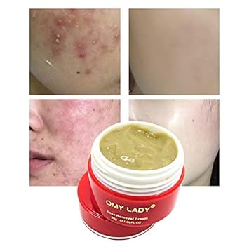 omy lady face cream