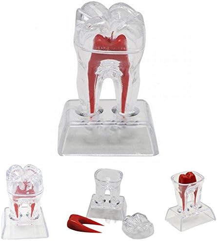 Oral Dentistry Dental Teeth Molar Model Crystal Base Separable Plastic Teaching Demonstration (1 Pcs)