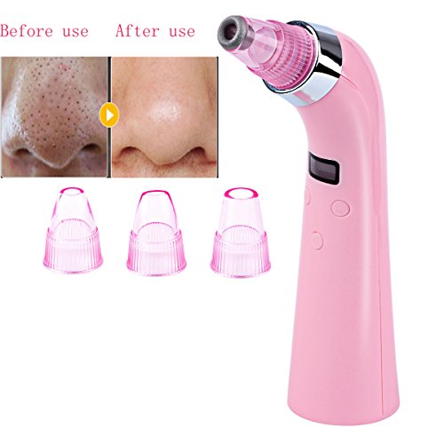 Comedo suction tool,ckeyin rechargeable diamond machine…