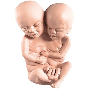Asylum Zone Siamese Twin Conjoined Fetus Latex Baby Fetal Pickled Punk Prop