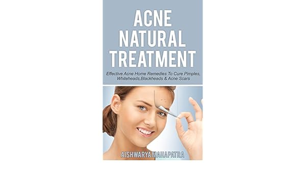 Acne Natural Treatment Effective Acne Home Remedies To Cure Pimples Whiteheads Blackheads Acne Scars - 