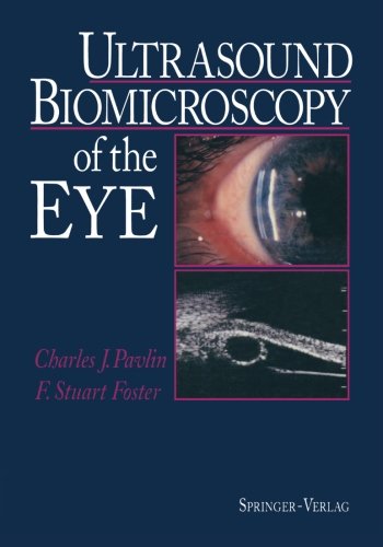 Ultrasound Biomicroscopy of the Eye