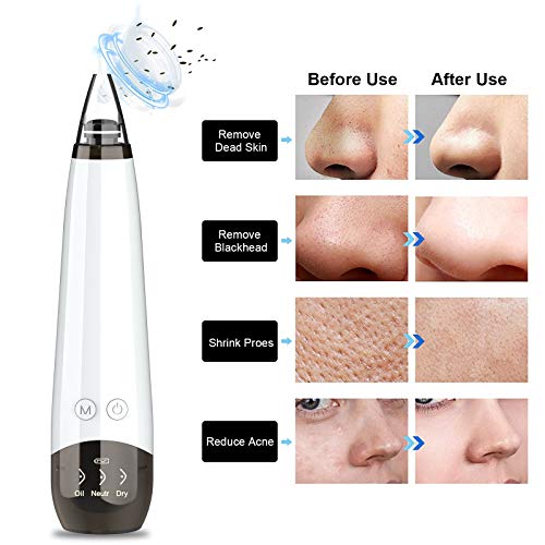 Blackhead Remover Pore Vacuum Facial Cleaner Electric Acne Extractor USB Rechargeable Comedo Removal Beauty Device with… - Image 3