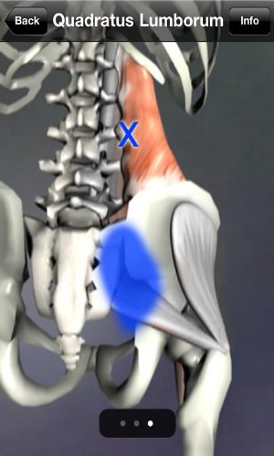 Amazon.com: Muscle Trigger Point Anatomy: Appstore for Android