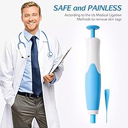 Skin Tag Remover, Upgraded 2 in 1 Skin Tag Removal