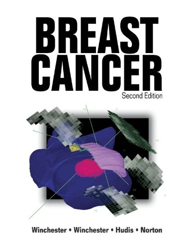 BREAST CANCER