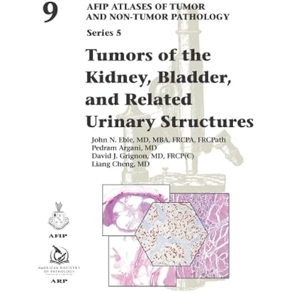 Tumors of the Pancreas (AFIP Atlas of Tumor and Non-Tumor