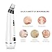 Zdatt Blackhead Remover Pore Vacuum with Beauty Lamp Care Comedo Suction Exfoliating Electric Comedone Acne Extractor Facial Cleaner with 5 Suction Heads and 5 Level Suction Force-FDA Approved