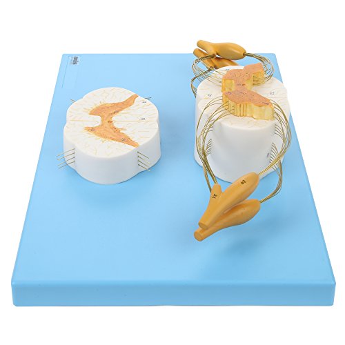 image for Axis Scientific Enlarged Spinal Cord Model | Shows 8X Life Size Nerves