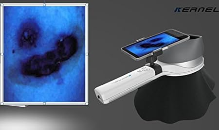 woods lampara piel revision uv luz dermatologia piel analizador