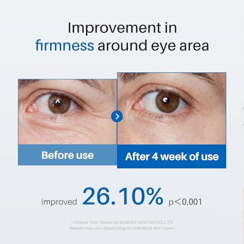 Caffeine Eye Cream, Under Eye Cream for Dark Circles, Puffiness & Puffy Bags, Wrinkles Fine Lines, Eye Roller Serum with 360° Massage Ball for Women and Men - 0.7 fl. oz