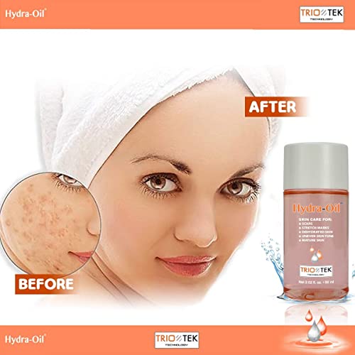 HydraOil Scar Removal Serum Scar Treatment for Face and Body 50 ml
