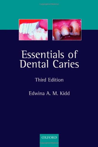 [Free] Essentials of Dental Caries: The Disease and Its Management [R.A.R]