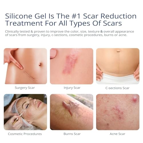 100% Silicone Scar Gel Scar Cream - Advanced Scar Gel for Surgical Scars, C-Section, Stretch Marks, Injury, Burns, Keloids, Old and New Scars