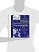 Cancer Immunotherapy: Immune Suppression and Tumor Growth