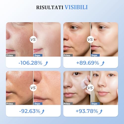 Oranmagic Professional Radiofrequency Face Massager, Microcurrent Facial Massager, Electric Beauty Device Anti-Wrinkle, Anti-Aging, Anti-Acne, Lifting and Firming for Face and Neck