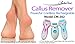 Rechargeable Pedicure Foot File Callous Remover - Electronic Foot Scrubber Removes Callus, Cracked, Dead, Hard Skin- A Must Have Foot Care Pedicure Tool (Purple)