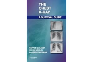 The Chest X-Ray: A Survival Guide