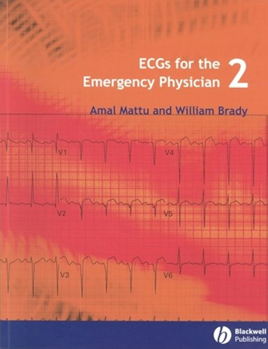 Download ECGs for the Emergency Physician 2 (English Edition) PDF